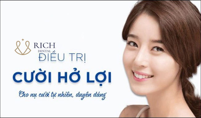 cuoi-ho-loi-la-gi