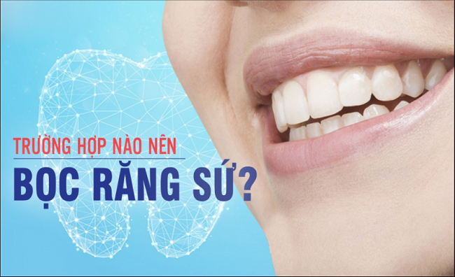 rang-su-tham-my-la-gi2