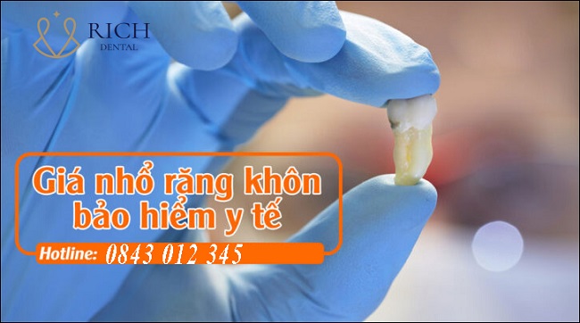 nho-rang-khon-co-bao-hiem-y-te-khong