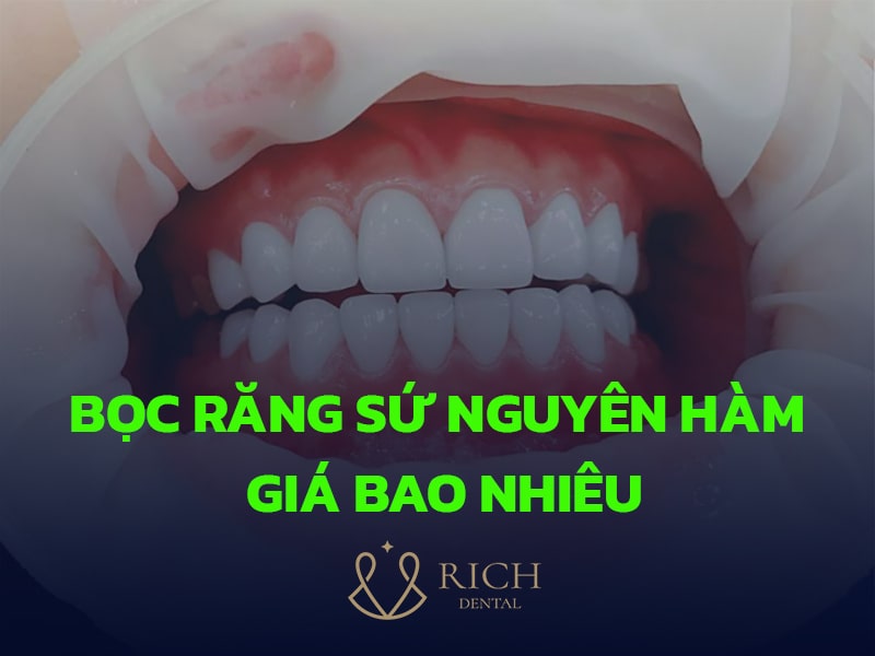 BOC-RANG-SU-NGUYEN-HAM-GIA-BAO-NHIEU