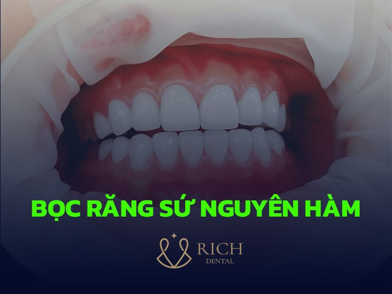 boc-rang-su-nguyen-ham