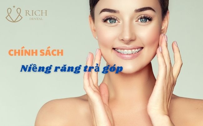 chinh-sach-nieng-rang-tra-gop