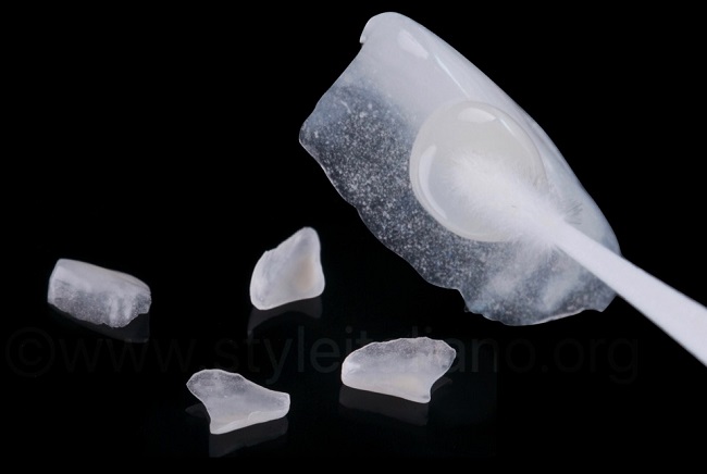 dan-su-veneer-tai-quang-ngai