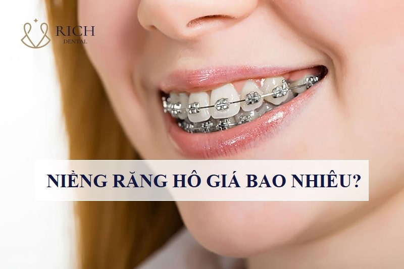 nieng-rang-ho-gia-bao-nhieu