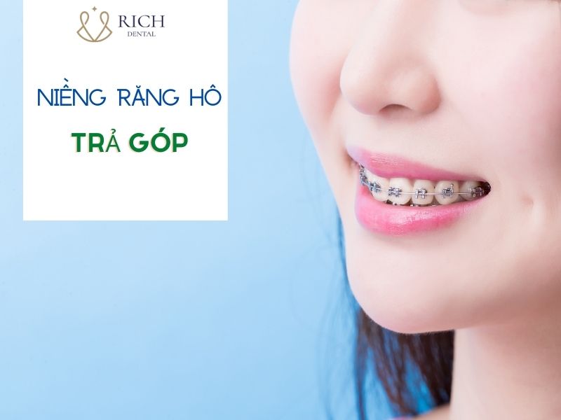 nieng-rang-ho-tra-gop