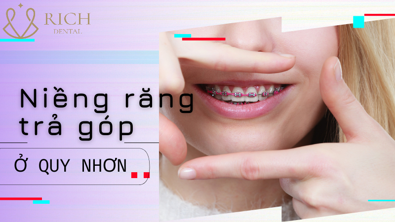 nieng-rang-tra-gop-o-quy-nhon