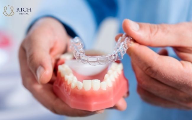 nieng-rang-trong-suot-invisalign