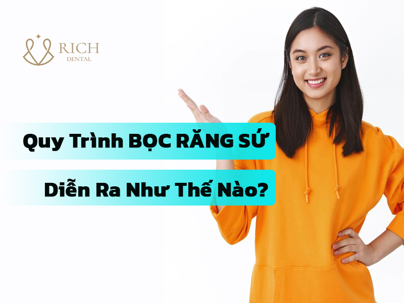 quy-trinh-boc-rang-su