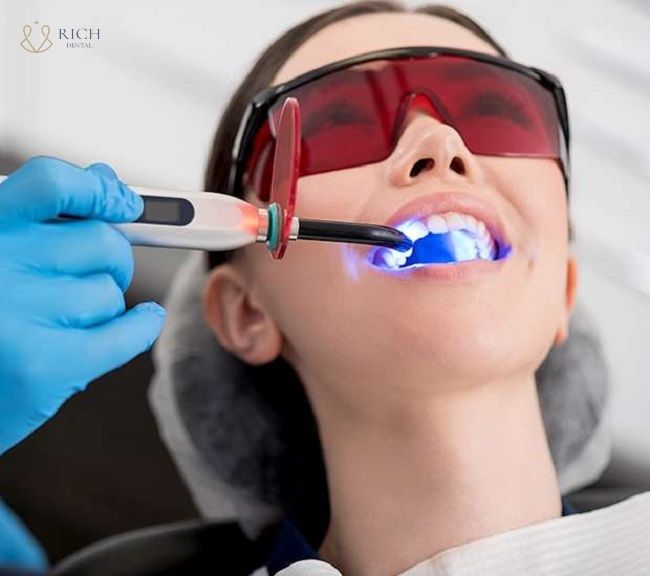 Tẩy Trắng Răng Bị Bỏng Nướu Phải Làm Sao tay-trang-rang-bi-bong-nuou-phai-lam-sao