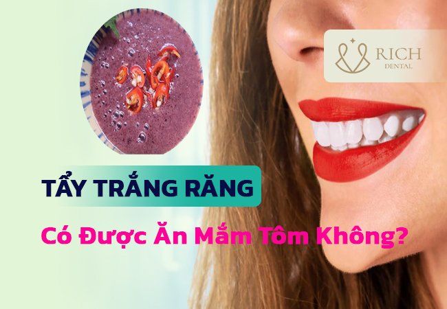 tẩy trắng răng có được ăn mắm tôm không