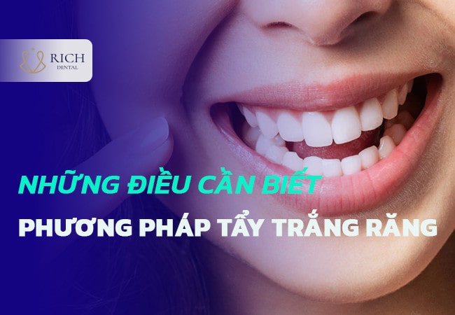 tẩy trắng răng