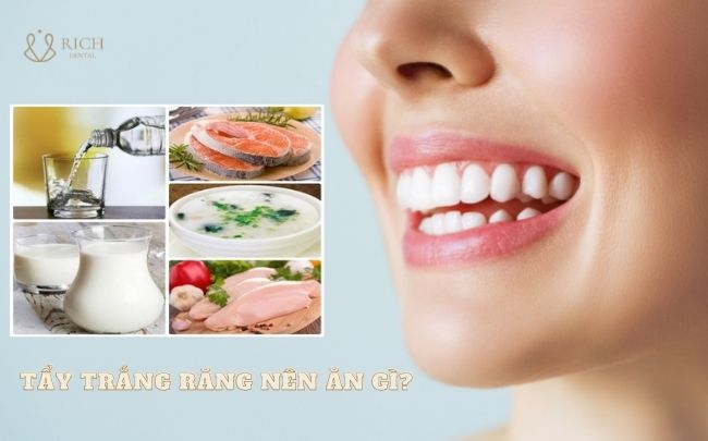 tẩy trắng răng có được uống bia không tay-trang-rang-nen-an-gi