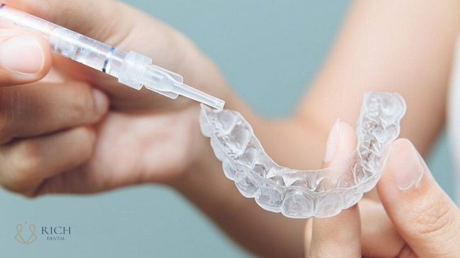tẩy trắng răng tại nhà bằng máng tay-trang-rang-tai-nha-bang-mang