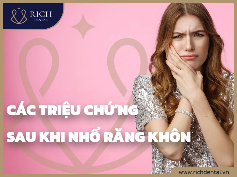 trieu-chung-sau-khi-nho-rang-khon