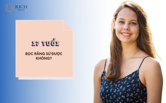 17-tuoi-boc-rang-su-duoc-khong