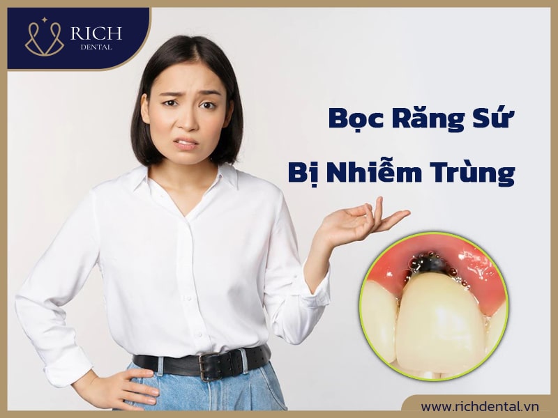 BOC-RANG-SU-BI-NHIEM-TRUNG