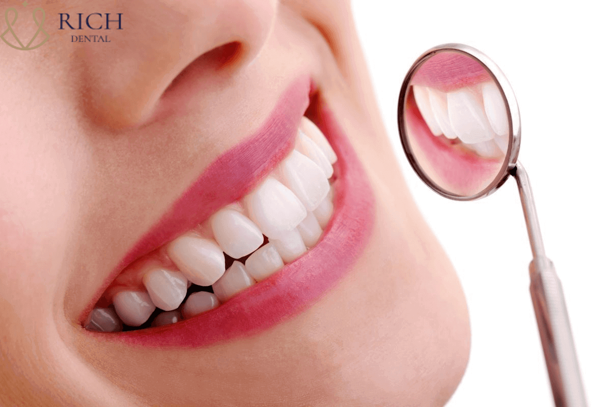 Bọc răng sứ 2 răng cửa Bọc răng sứ 2 răng cửa