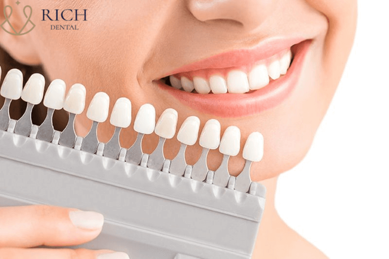 Bọc răng sứ 2 răng cửa Bọc răng sứ 2 răng cửa
