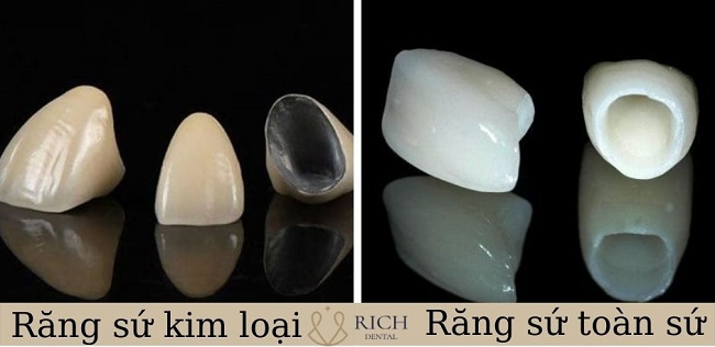 boc-rang-su-cho-rang-cua-bi-me