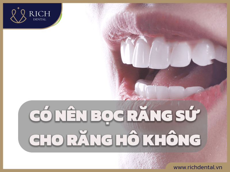co-nen-boc-rang-su-cho-rang-ho