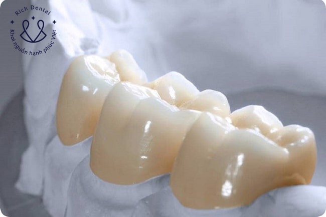boc-rang-su-zirconia
