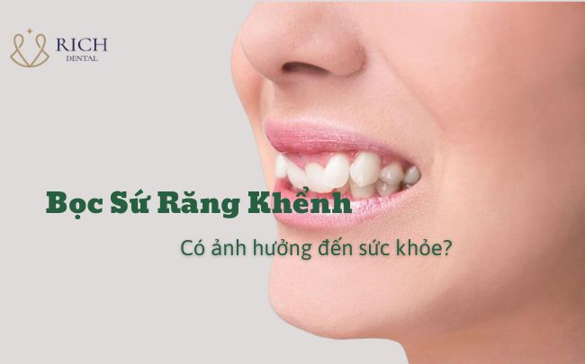 boc-su-rang-khenh-co-anh-huong-suc-khoe