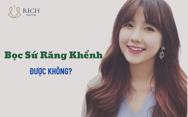 Bọc Sứ Răng Khểnh boc-su-rang-khenh-duoc-khong