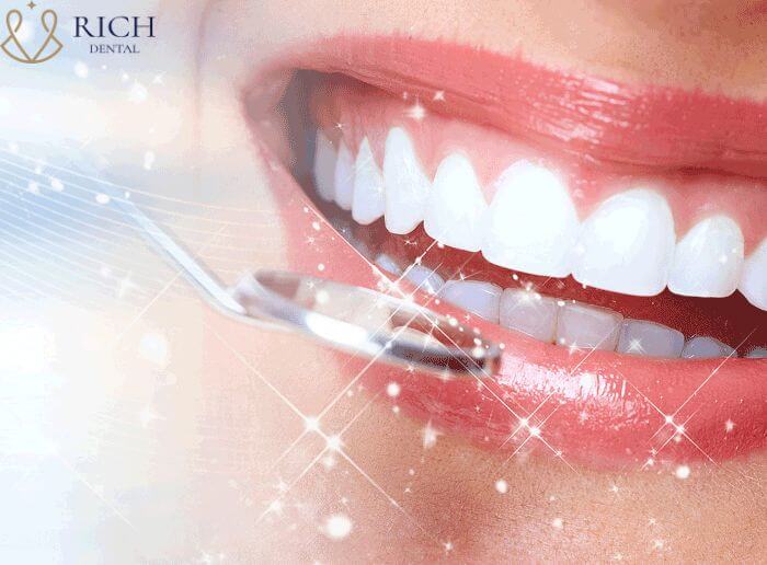 Công nghệ bọc răng sứ majestic nano 5k Với màu sắc trong suốt, tự nhiên giống răng thật, hiệu quả thẩm mỹ mà Majestic Nano mang lại khá tốt.