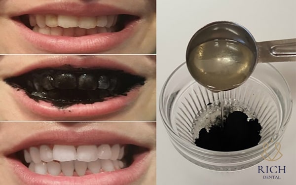làm trắng răng bằng than củi