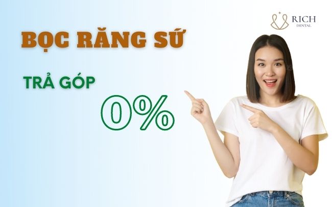 loi-ich-cua-boc-rang-su-tra-gop