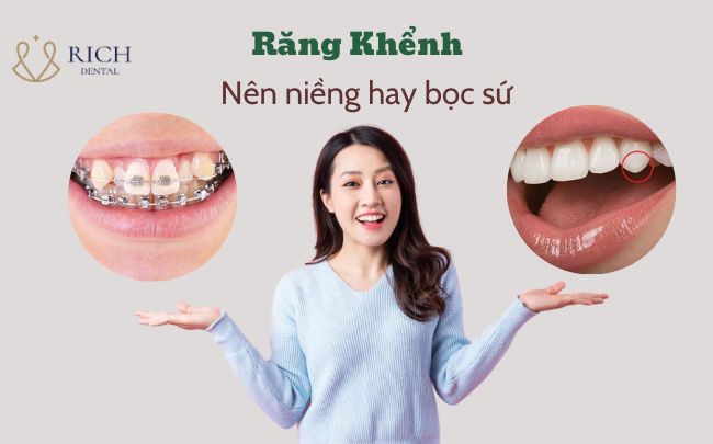 nen-nieng-hay-boc-su-rang-khenh