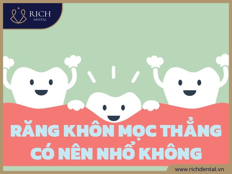 rang-khon-moc-thang-co-nen-nho-khong-10