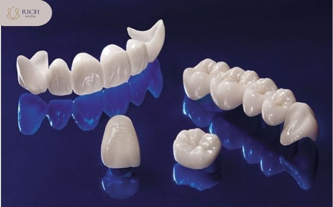 Bọc Răng Sứ Cao Cấp rang-su-cercon-va-cercon-ht