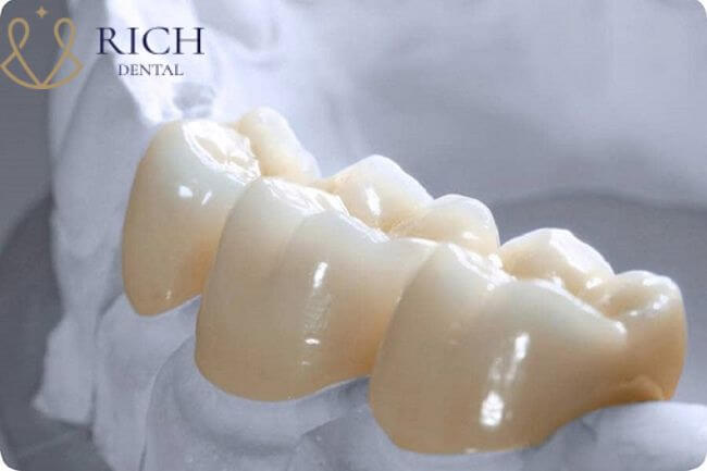 răng sứ titan và răng sứ zirconia Răng sứ Zirconia là một trong những chất liệu thuộc nhóm răng sứ toàn sứ.