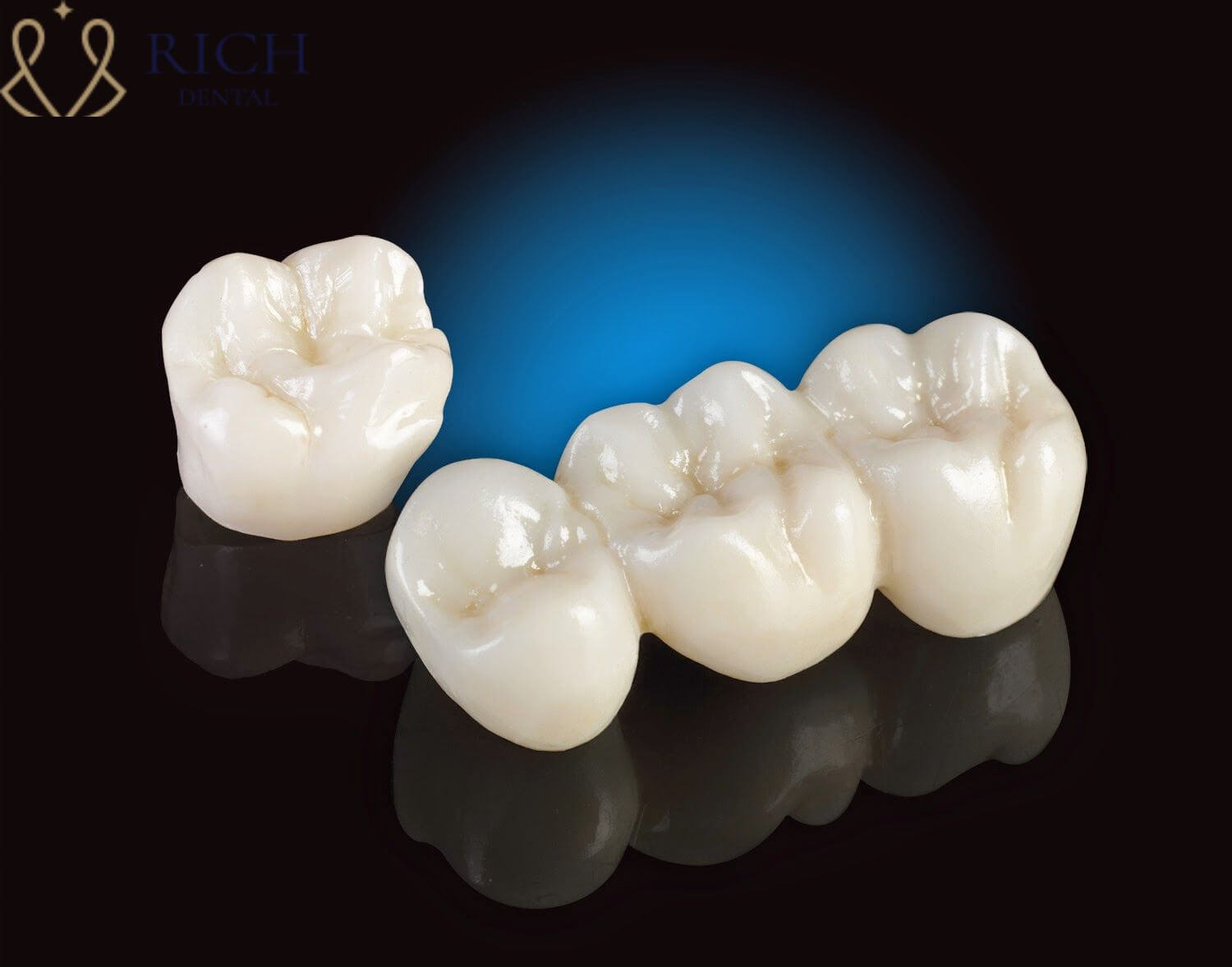 răng toàn sứ vita giá bao nhiêu Răng toàn sứ Vita là loại răng có xuất sứ từ Đức.