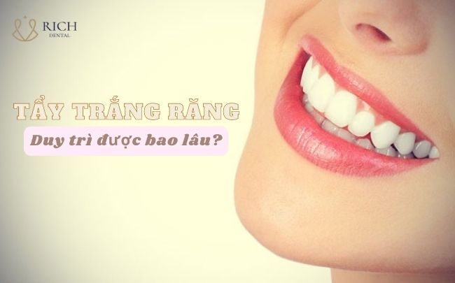 Tẩy Trắng Răng Duy Trì Được Bao Lâu tay-trang-rang-giu-duoc-bao-lau
