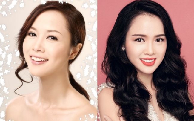 vu-ngoc-anh-cai-thien-nu-cuoi-nho-boc-rang-su