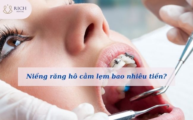 chi-phi-nieng-rang-ho-cam-lem