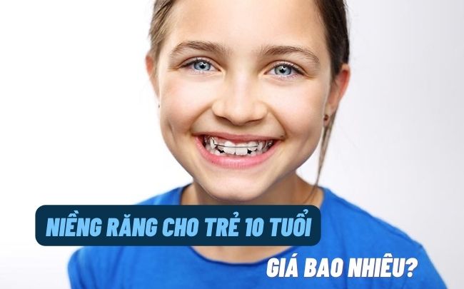 gia-nieng-rang-cho-tre-10-tuoi