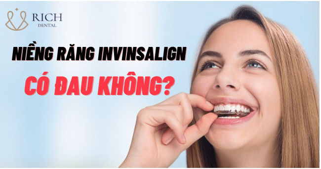 nieng-rang-invisalign-co-hieu-qua-khong