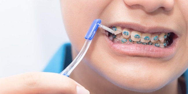 nieng-rang-xong-van-xau