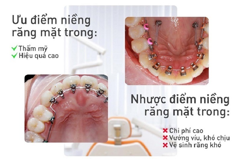 nieng-rang-mat-trong