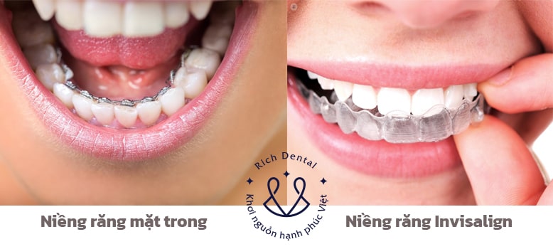 nieng-rang-mat-trong