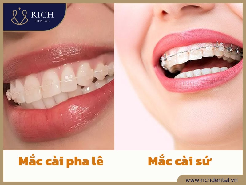 so-sanh-mac-cai-pha-le-va-su